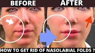 HOW TO GET RID OF NASOLABIAL FOLDS WITH FACE YOGA ? SAGGY SKIN JOWLS FOREHEAD LINES FROWN LINES