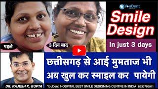 SMILE MAKEOVER IN INDIA स्माइल को ठीक करें केवल  3  दिनों में INDIAS BEST SMILE DESIGNING CENTRE