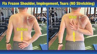 INCREDIBLE way to Fix Frozen Shoulder & Impingement - NO Stretching or PT Exercises