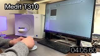 Сравнение Medit T310 vs Exostom RapidScan