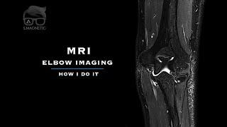 MRI ELBOW IMAGING – How I Do It