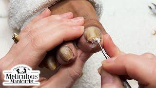 Pedicure Tutorial How to Relieve Pain in Your Toenails