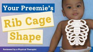 Baby’s Changing Rib Cage How to Support Your Preemie’s Growth