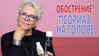 ОБОСТРЕНИЕ ПСОРИАЗ на ГОЛОВЕ