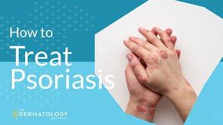 Psoriasis Treatment - Explained by Dermatologist