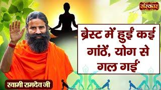 ब्रेस्ट में हुईं कई गाठें योग से गल गईं  Lumps Treatment  Yoga and Ayurveda  Swami Ramdev Ji