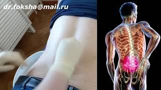 ЛЕЧЕНИЕ ОСТЕОХОНДРОЗА l БЛОКАДА l ЛОКАЛЬНАЯ ИНЪЕКЦИОННАЯ ТЕРАПИЯ l LOCAL INJECTION THERAPY BACK PAIN