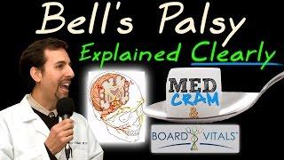 Bells Palsy Explained Clearly - Exam Practice Question