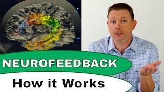 How Does Neurofeedback Therapy Work