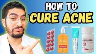 99% Overlook These Effective Acne Treatments – 2024 Guide