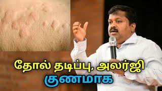 தோல் அலர்ஜி தடிப்பு குணமாக இயற்கை மருத்துவம்  Dr.Sivaraman speech on remedy for skin allergy