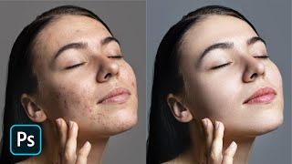 Mastering Frequency Separation Achieve Smooth Flawless Skin in Photoshop  Photoshop tutorial 2024