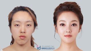 Double Jaw Surgery Asymmetrical Face Korea Plastic Surgery  Let Me In TV Show