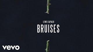 Lewis Capaldi - Bruises Official Audio