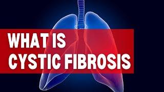 What is cystic fibrosis - ask me anything about cystic fibrosis  what is cystic fibrosis?