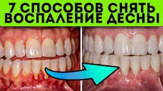 Десна кровоточили не ел 3 суток пока… простой народный рецепт от воспаления десен