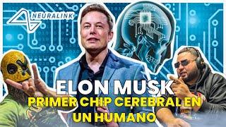 Elon Musk Logro Implantar Con Éxito El Primer Chip Cerebral En Un Humano  Inteligencia Artificial