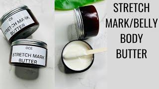 DIY STRETCH MARKBELLY BODY BUTTER FOR AMAZING SKIN MOISTURE