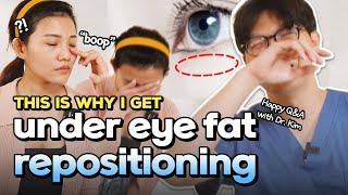 Do you know why you look always tired? Get more idea about Under eye fat reposition surgery