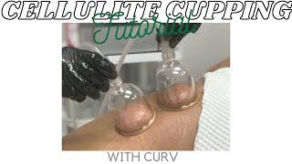 Cellulite Cupping Tutorial  How To Use Cellulite Cupping  Curv Vacuum and Cupping System