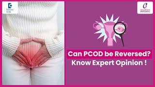 How to reverse PCOS Polycystic Ovarian Syndrome?- Dr.Deepthi Dandamudi  Doctors Circle