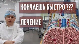 Преждевременная эякуляция  Лечение