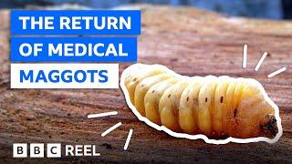 Why maggots are a medical marvel – BBC REEL