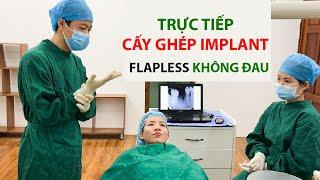 Quy trình trồng răng Implant không đau bằng kỹ thuật mới  Nha Khoa Thùy Anh