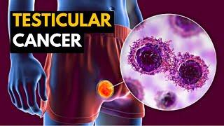 Testicular Cancer Causes Signs and Symptoms Diagnosis and Treatment.