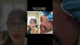 Jerawat jadi makin parah gara2 lakuin ini ‼️ #youtubeshorts #shorts #dokterkulit #acne