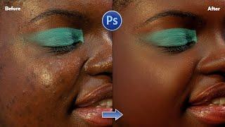 High-End Skin Retouching In 5 Minutes In Photoshop