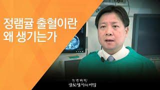 정램귤 출혈이란 왜 생기는가 - 2011.2.12_361회 방송_당신의 간이 굳어간다 침묵의 질환 간경화