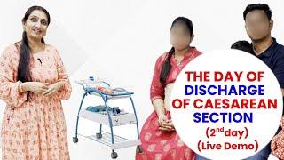 The Day of Discharge of Caesarean section Day 2   Live Demo - Dr Asha Gavade