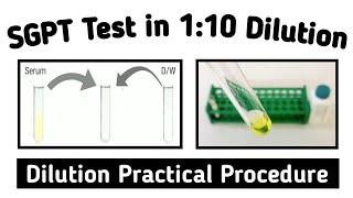 How to make 110 dilution for biochemistry Test  SGPT Test in Dilution