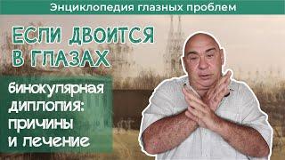 Почему двоится в глазах  Бинокулярная диплопия