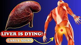 LIVER is DYING 12 Weird Signs of LIVER DAMAGE  Health care