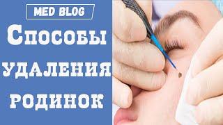 Как удалить родинку?  Хирургические способы удаления невусов на лице и теле  Плюсы и минусы