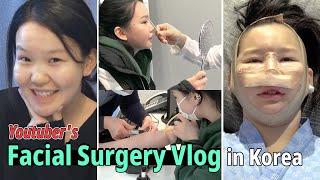 SUB Youtubers Plastic Surgery Vlog in Korea  Rhinoplasty Facial Liposuction with Lifting