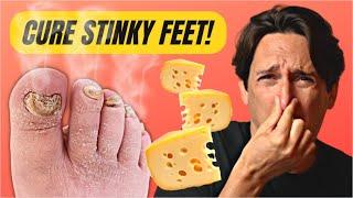 TREATMENTS for SMELLY FEET