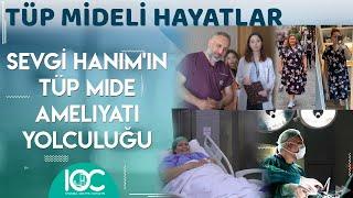 Sevgi Hanımın Tüp Mide Ameliyatı Yolculuğu  İstanbul Obezite Cerrahisi