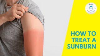 Summer Health Bummers – Sunburn  How to treat a sunburn