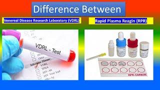 Venereal disease research laboratory VDRL test  Vs. Rapid plasma reagin RPR test