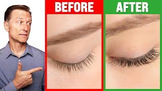 How to Grow Long Thick Eyelashes QUICKLY - Dr. Berg