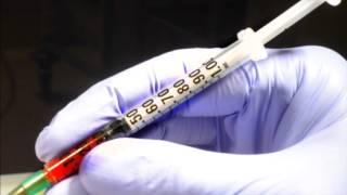 How to take an arterial blood gas sample from the radial artery