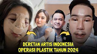 Deretan Artis Operasi Plastik di Tahun 2024