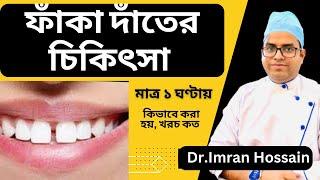 ফাঁকা দাঁতের চিকিৎসা ও খরচ  Tooth space  gap closure  Dr. Imran  ফাঁকা দাঁতের ঘরোয়া চিকিৎসা