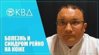 1404  Болезнь и синдром Рейно на коже