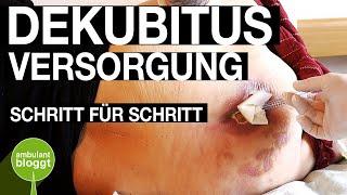 Dekubitus und Z.n. Amputation Versorgung  moderne Wundversorgung  Schritt für Schritt  Charcotfuß