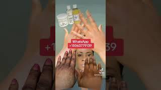 How to treat dark hands and dark feet Skin care range #usa #fypシ゚ #canada_life #montreal