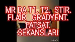 MR DA  T1 T2  STIR FLAİR GRADYENT SEKANSLARI